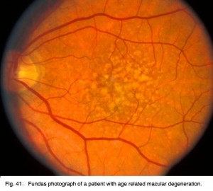 Figure 1. [The normal human retina fundus]. - Webvision - NCBI